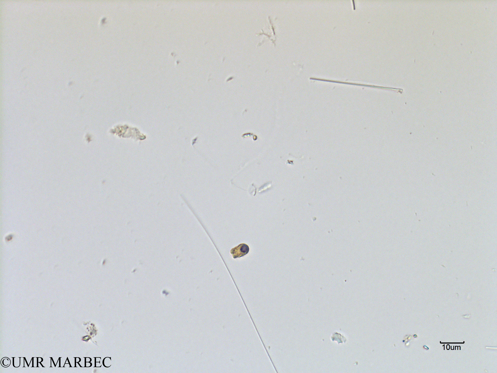 phyto/Scattered_Islands/mayotte_lagoon/SIREME May 2016/Nanoflagellé 9 (MAY3_flagelle- ancien microflagellé 8).tif(copy).jpg